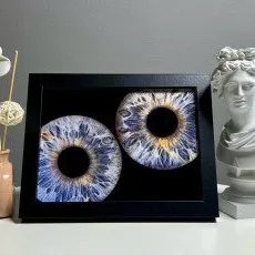 Парное фото радужки глаз в Балашихе