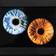 Фото радужки глаза